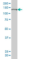 WB - SFRS14 Antibody (monoclonal) (M01) AT3845a